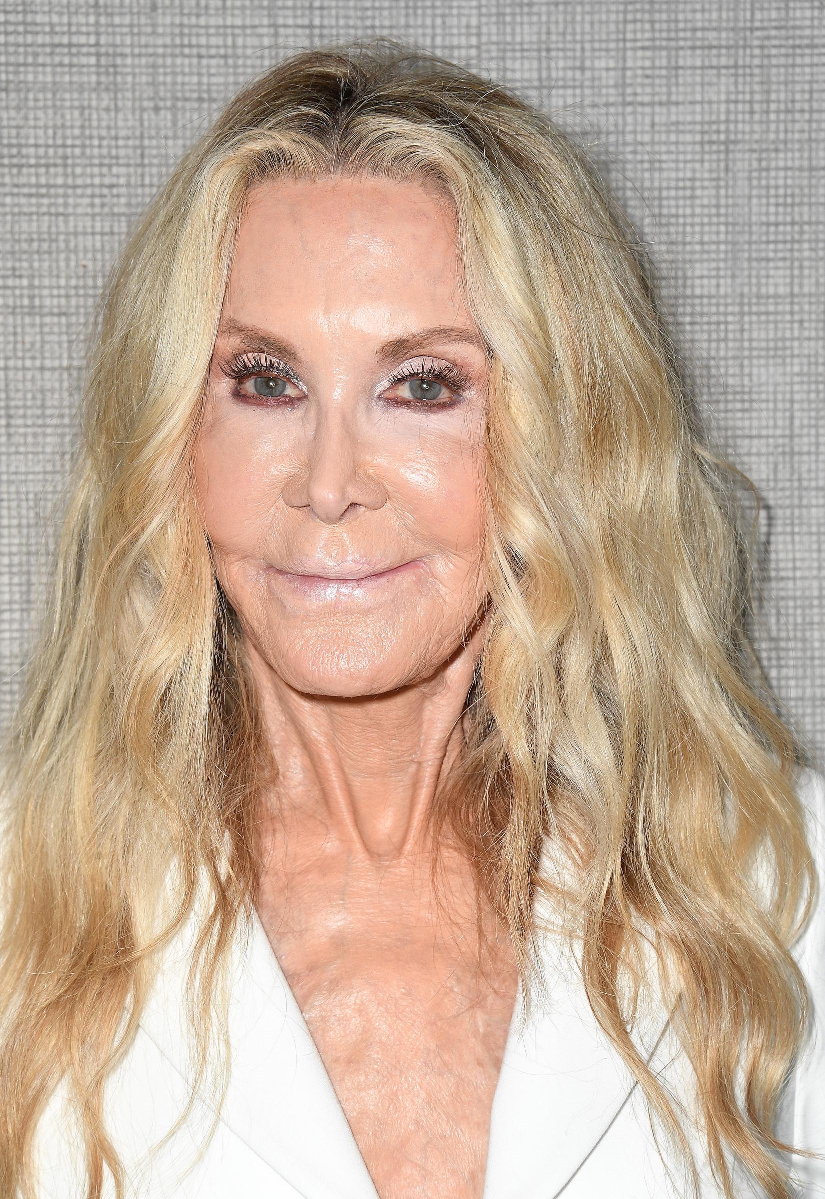 A close-up of Joan Van Ark at a Hollywood event captured the appearance that prompted a wave of online discussion, with some commenters expressing sadness over how different they felt she looked from her younger years. | Source: Getty Images