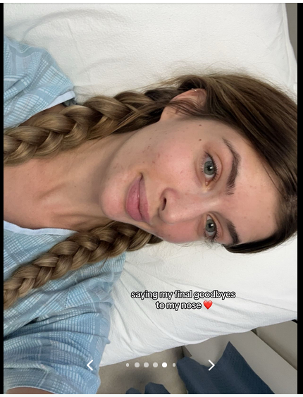 Sami Sheen shares her experience getting a nose job done, on a TikTok post dated August 13, 2024