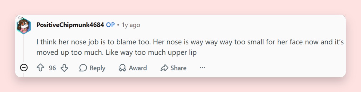 A Redditor questioned whether changes to Miley Cyrus’s facial proportions could explain why her appearance seems so different, sparking further discussion about the singer’s rumored cosmetic procedures. | Source: Reddit/r/VindictaRateCelebs