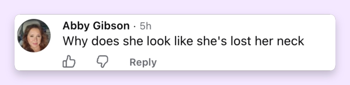 Some of the discussion shifted from Madonna’s movement to her appearance, with one viewer questioning the way her neck looked on camera.