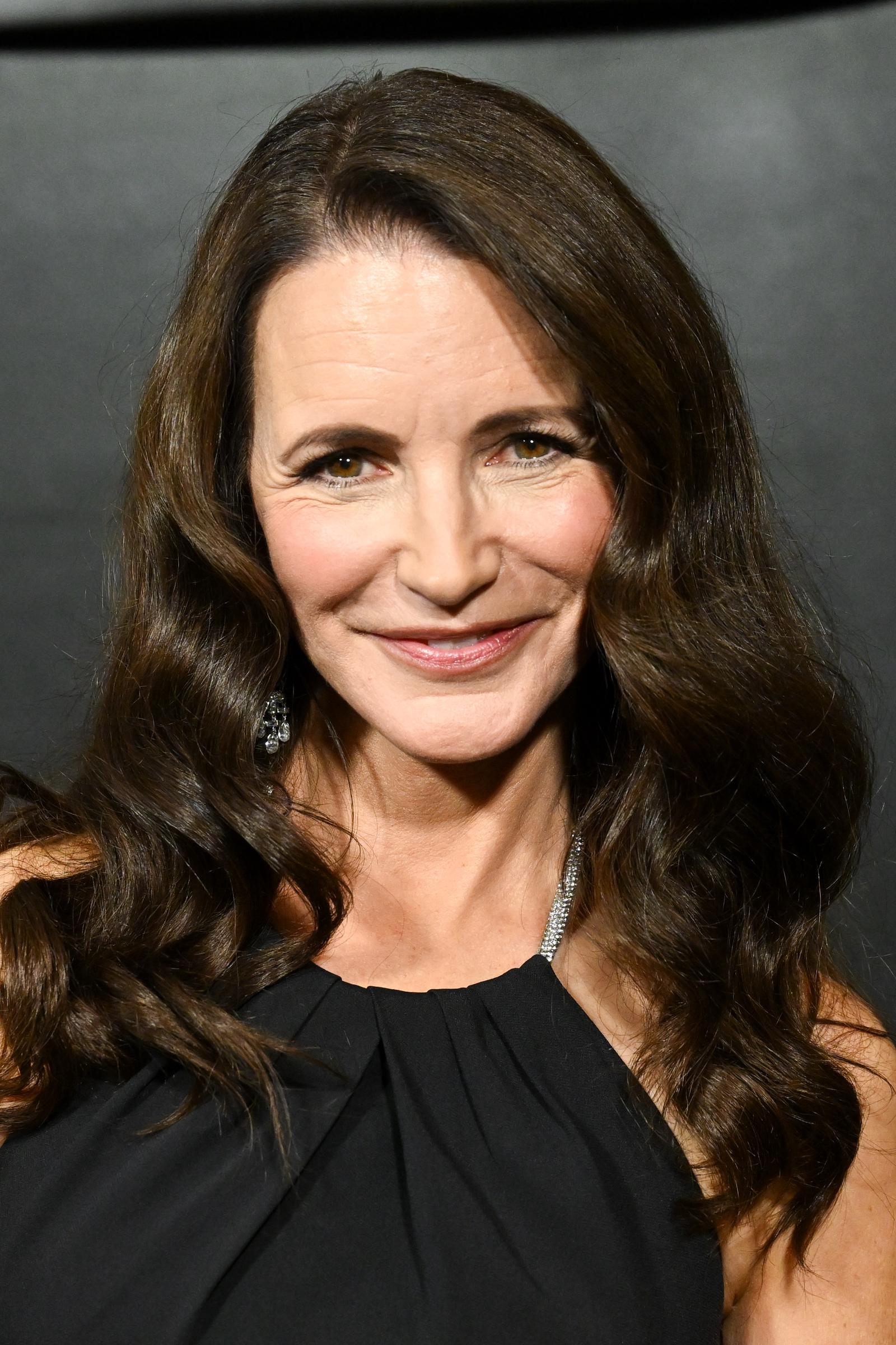 Davis had spoken candidly about having some filler dissolved after being unhappy with the results. She also described the public scrutiny surrounding her appearance as stressful.