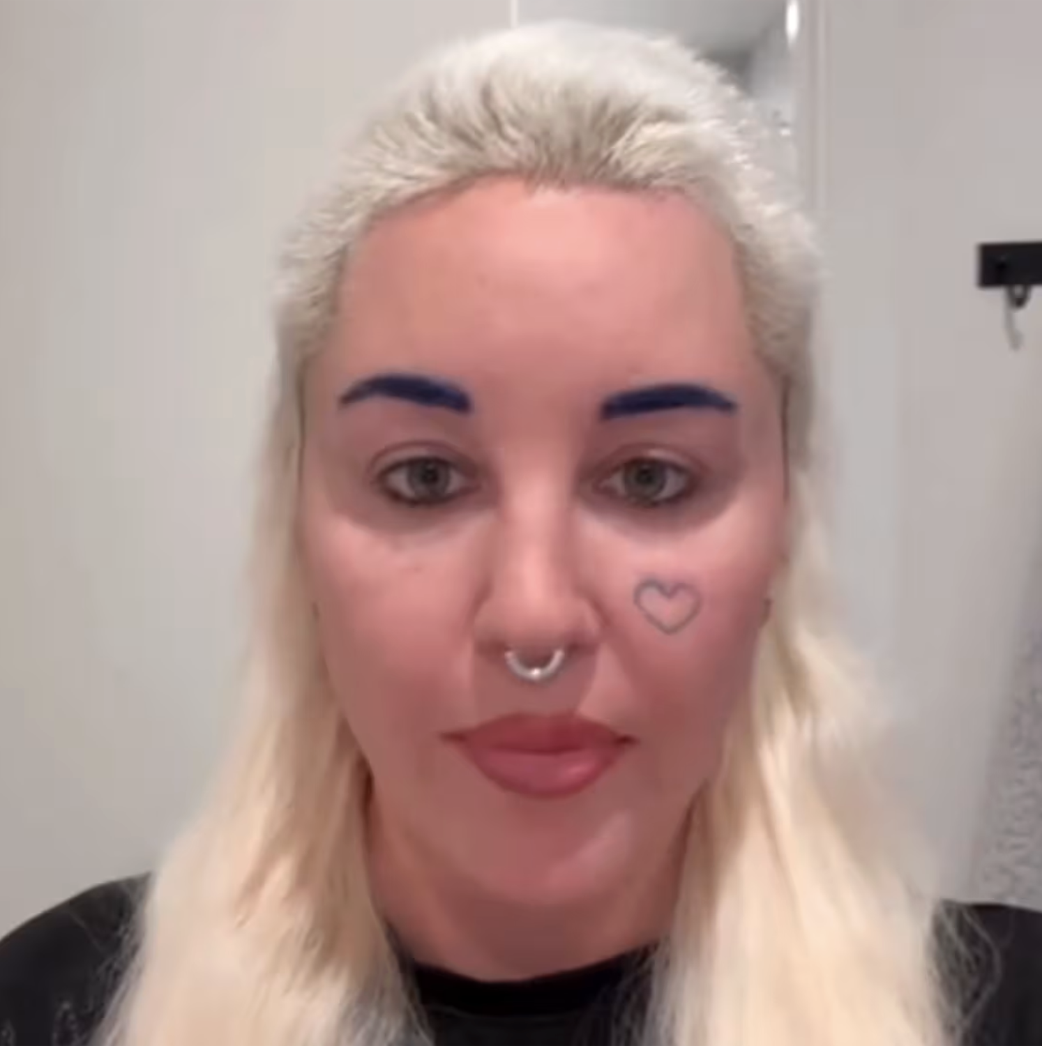 Bynes shows her appearance after undergoing blepharoplasty in the 2023 social media video in which she publicly confirmed the eyelid surgery. | Source: tiktok/amandaamandaamanda1986