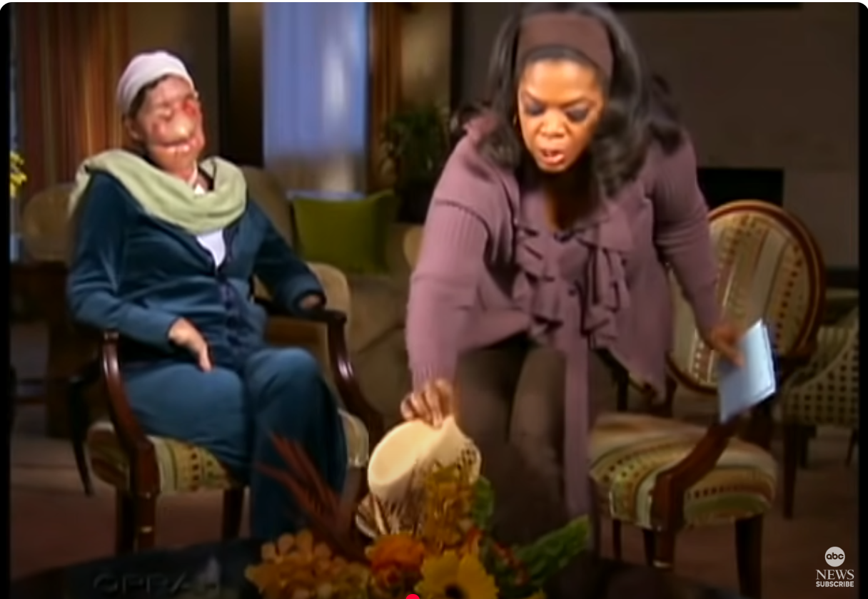 Oprah Winfrey takes off Charla Nash's veil as seen on ABC News' YouTube channel, dated November 11, 2009 | Source: YoTube/ABCNews