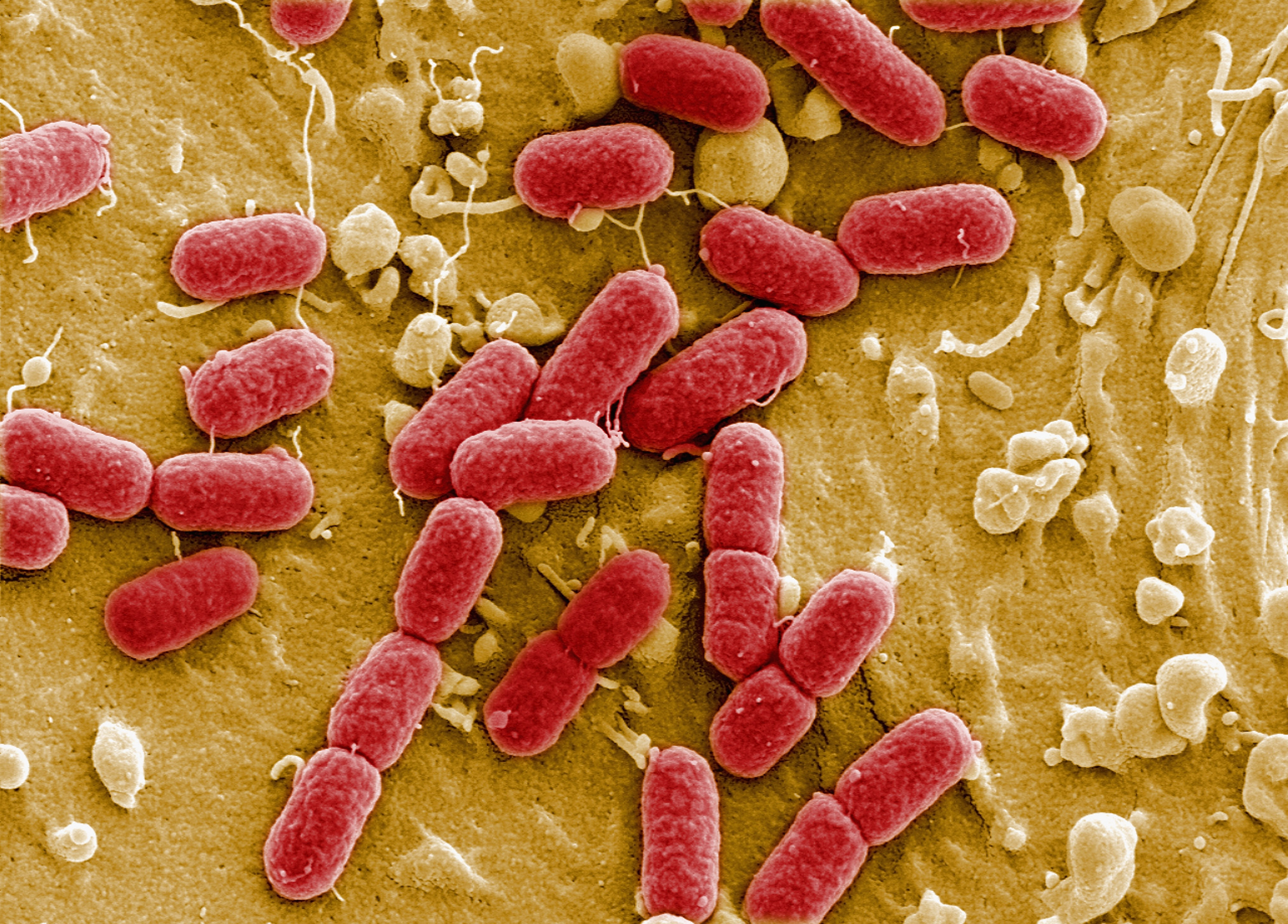 Possible E. coli contamination is among the concerns behind these recalls. | Source: Getty Images