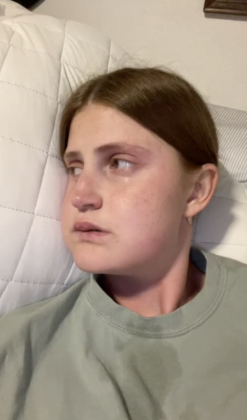 Still visibly swollen and emotional, Virginia Elder records her third day of healing from surgery. | Source: TikTok/virginiaeelder