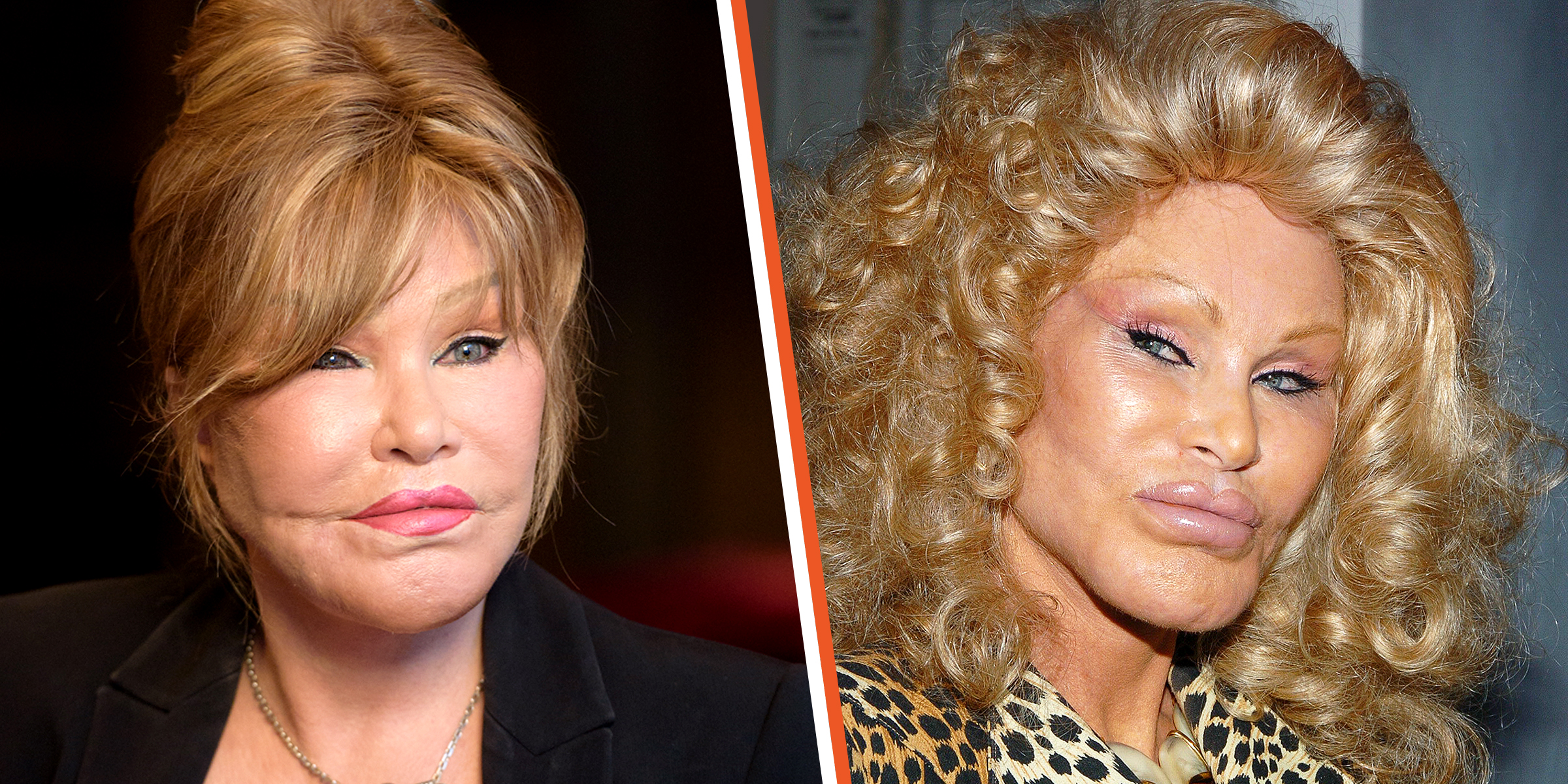 Jocelyn Wildenstein | Source: Getty Images