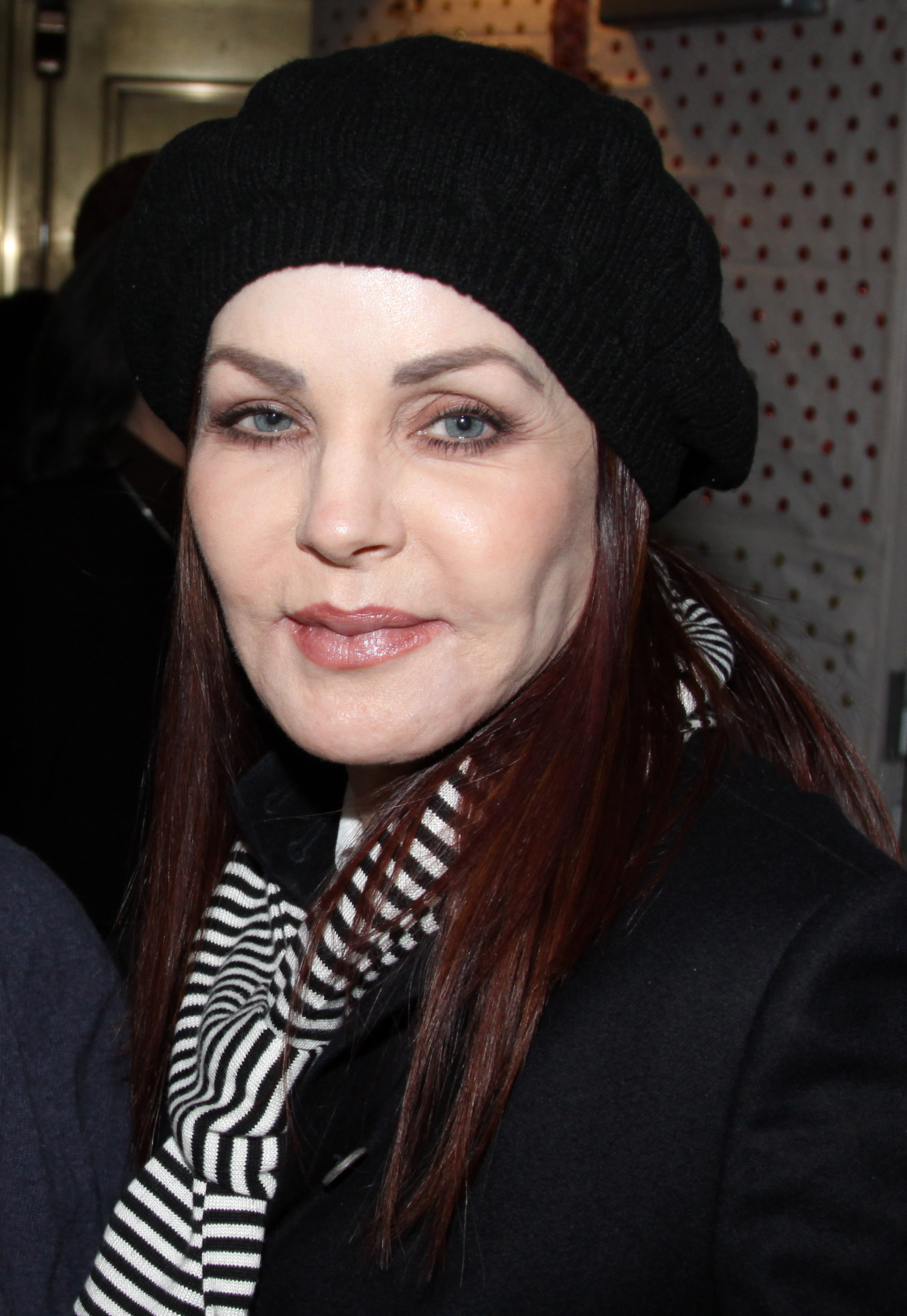 Presley reportedly sought corrective work after discovering the truth about the injections. That history remains vital context as older and newer photos of her continue to draw intense public scrutiny.