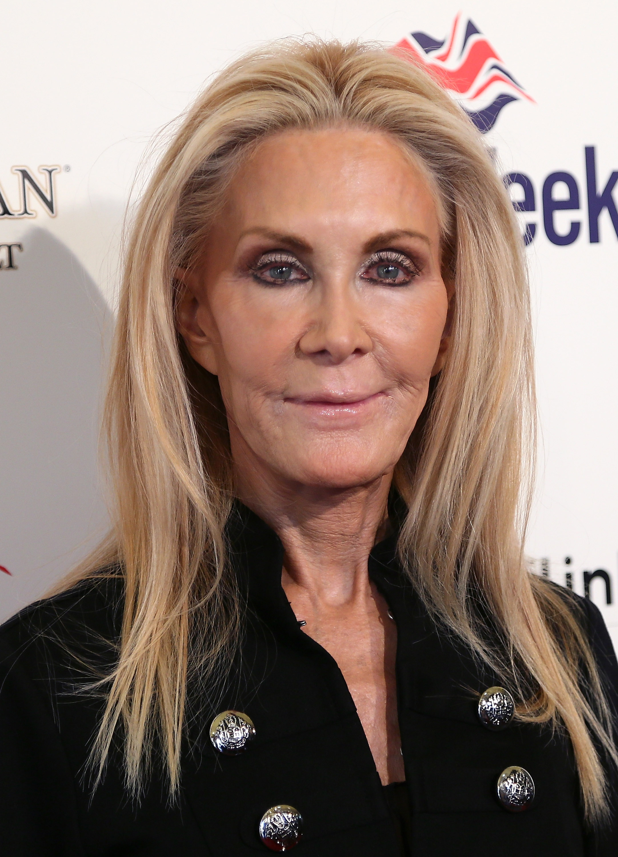 Joan Van Ark attended a public event during a period when her appearance became the subject of widespread public speculation, with some cosmetic surgeons offering opinions based only on publicly available photographs rather than any confirmed medical information. | Source: Getty Images