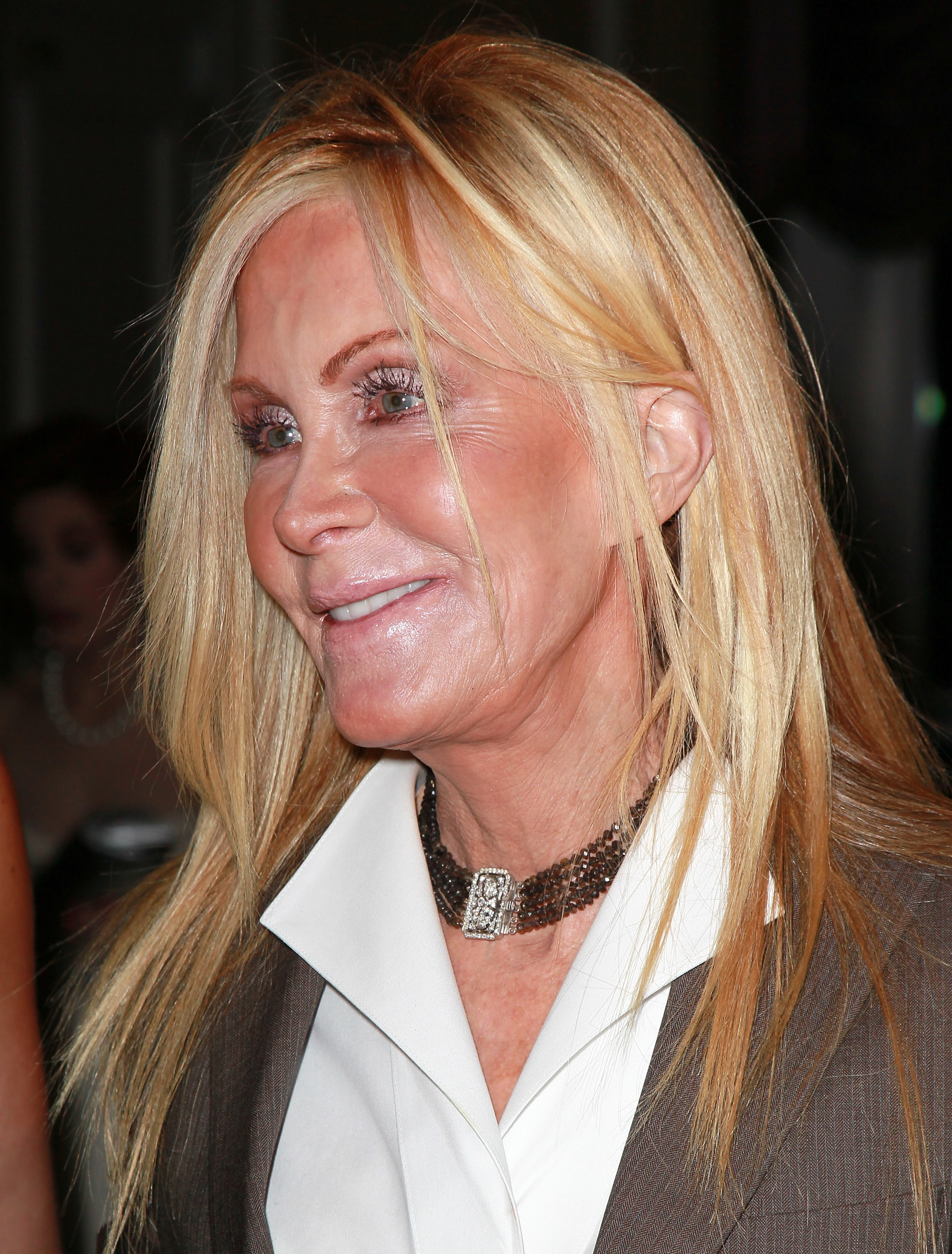 Joan Van Ark attended a Hollywood charity event as media attention increasingly focused on her appearance, fueling years of public speculation about possible cosmetic procedures. | Source: Getty Images