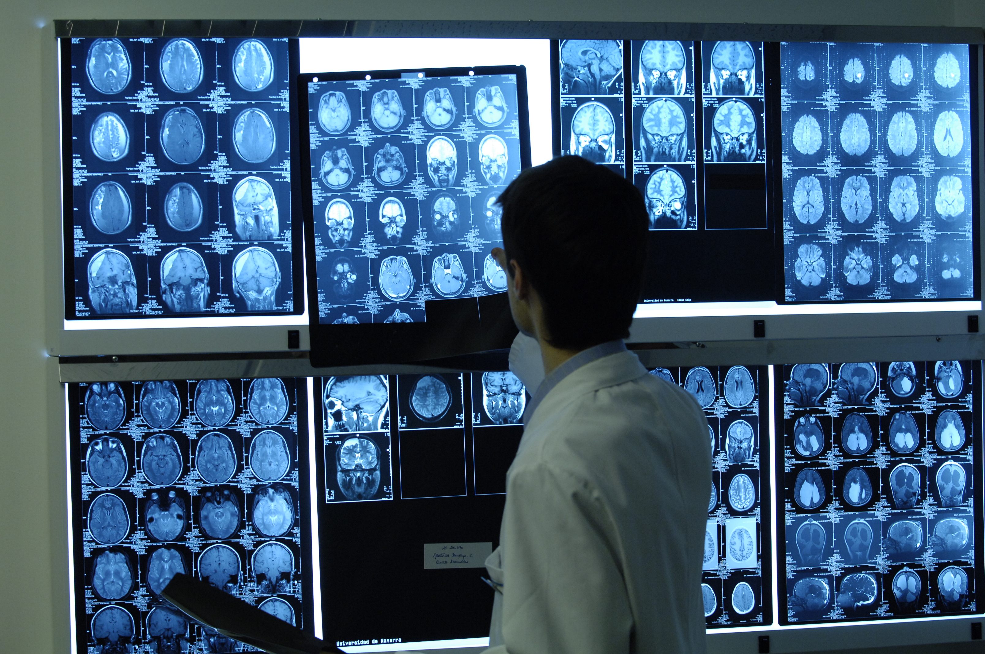 A medical professional reviews several radiological images on a film illuminator. | Source: Wikimedia Commons
