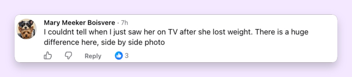 Another commenter admitted that Metz's transformation hadn't seemed as noticeable on television, but seeing the two photographs side by side made the dramatic change impossible to miss.| Source:" Facebook/New York Post Entertainment