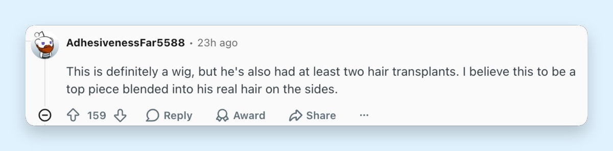 A commenter speculates about Fraser's fuller hair, suggesting that his new hairstyle involves a hairpiece and cosmetic procedures. | Source: Reddit/ r/popculturechat