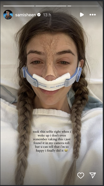 SSami Sheen shares her experience after undergoing a nose job, on her Instagram Stories on August 15, 2024
