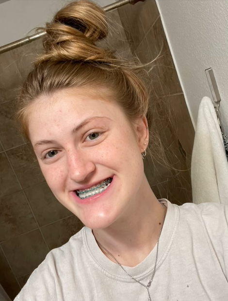 Virginia Elder shares a bathroom selfie, smiling with braces during the early stages of her orthodontic journey. | Source: TikTok/virginiaeelder
