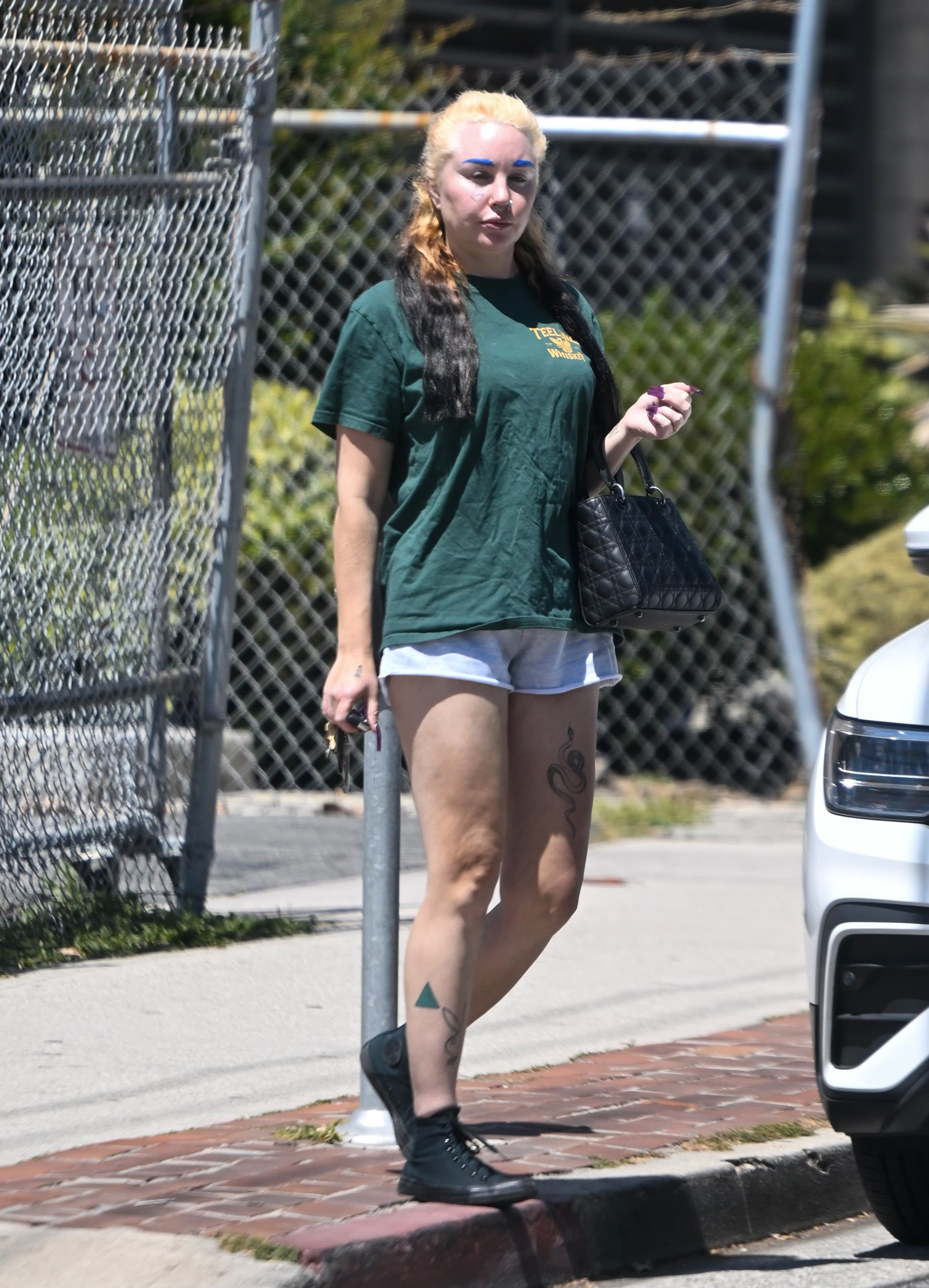 Amanda was photographed in April 2026, nearly a year after publicly announcing her weight-loss plans. She had previously revealed that her goal was to feel more confident in paparazzi photographs. | Source: Getty Images.