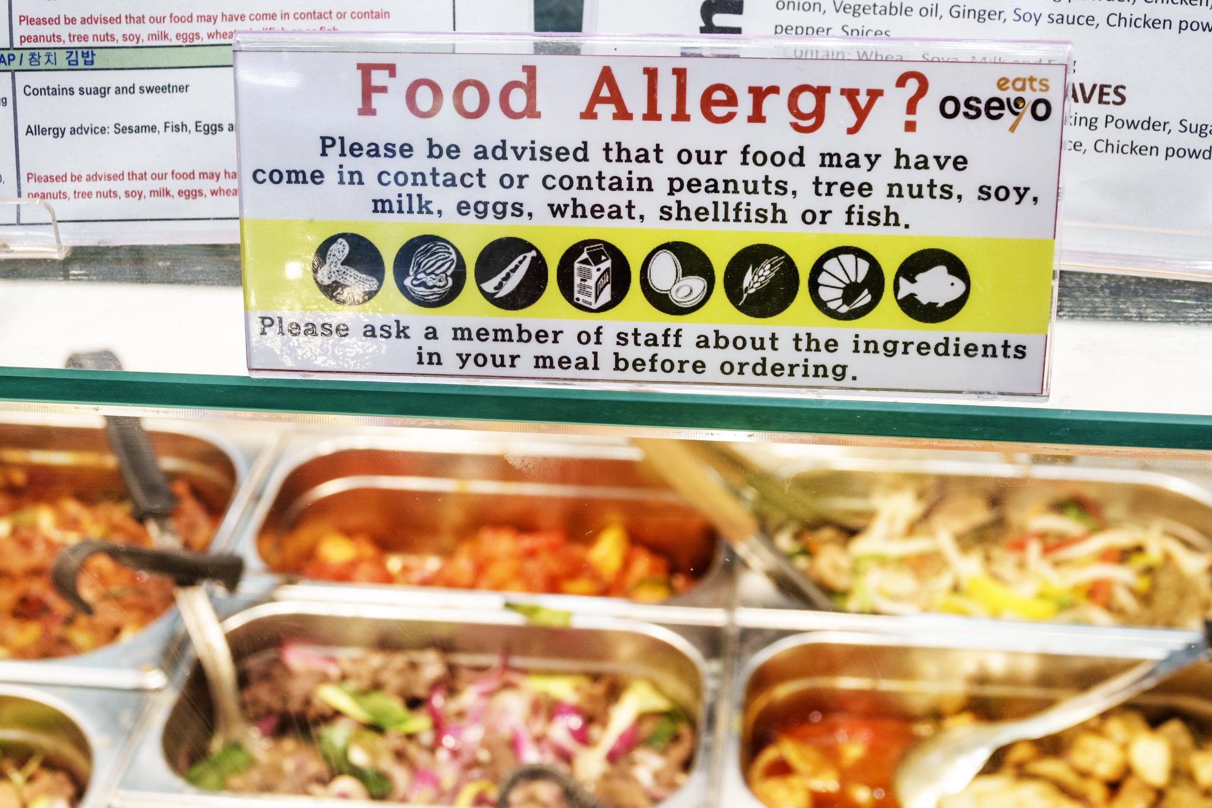 Food allergy warning signage over a buffet in London in August 2018. | Source: Getty Images