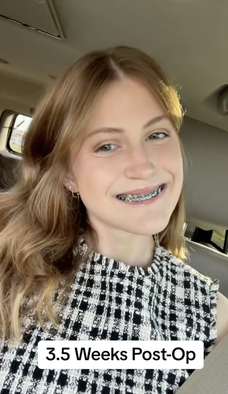 Virginia Elder smiles wide, braces still visible but swelling nearly gone. | Source: TikTok/virginiaeelder