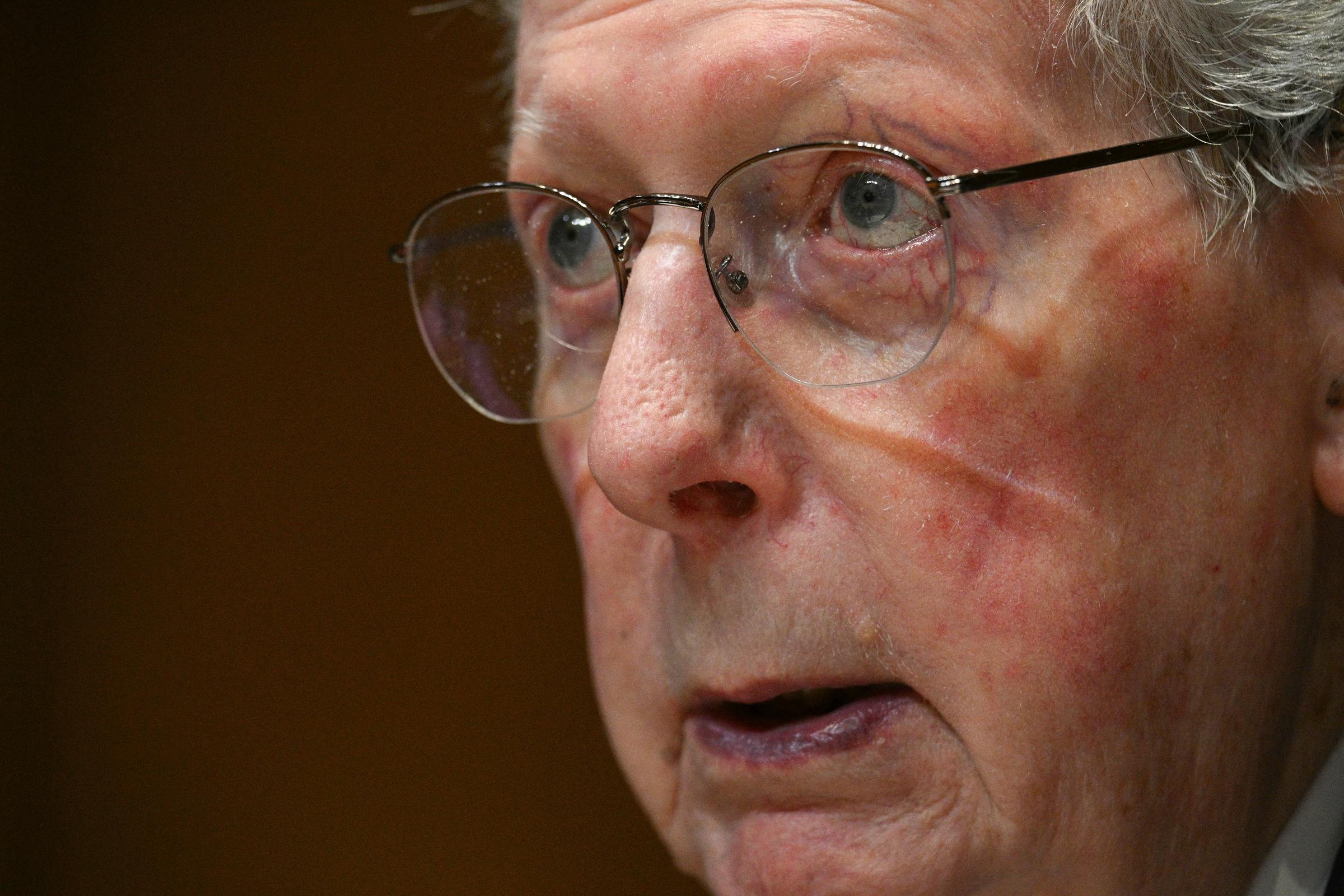 Mitch McConnell appears in a tight close-up during a Senate hearing, years after a series of health scares brought increased attention to his well-being. | Source: Getty Images