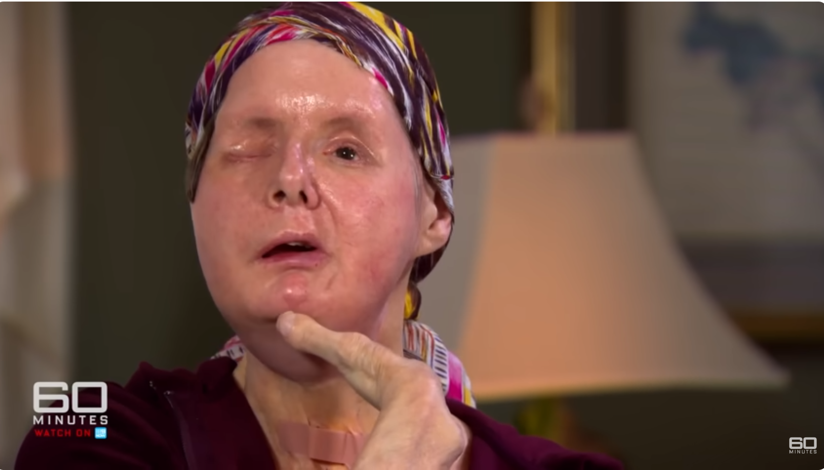 Charla Nash expressing gratitude during interview with 60 Minutes Australia, dated June 11, 2025 | Source: YouTube/60MinutesAustralia