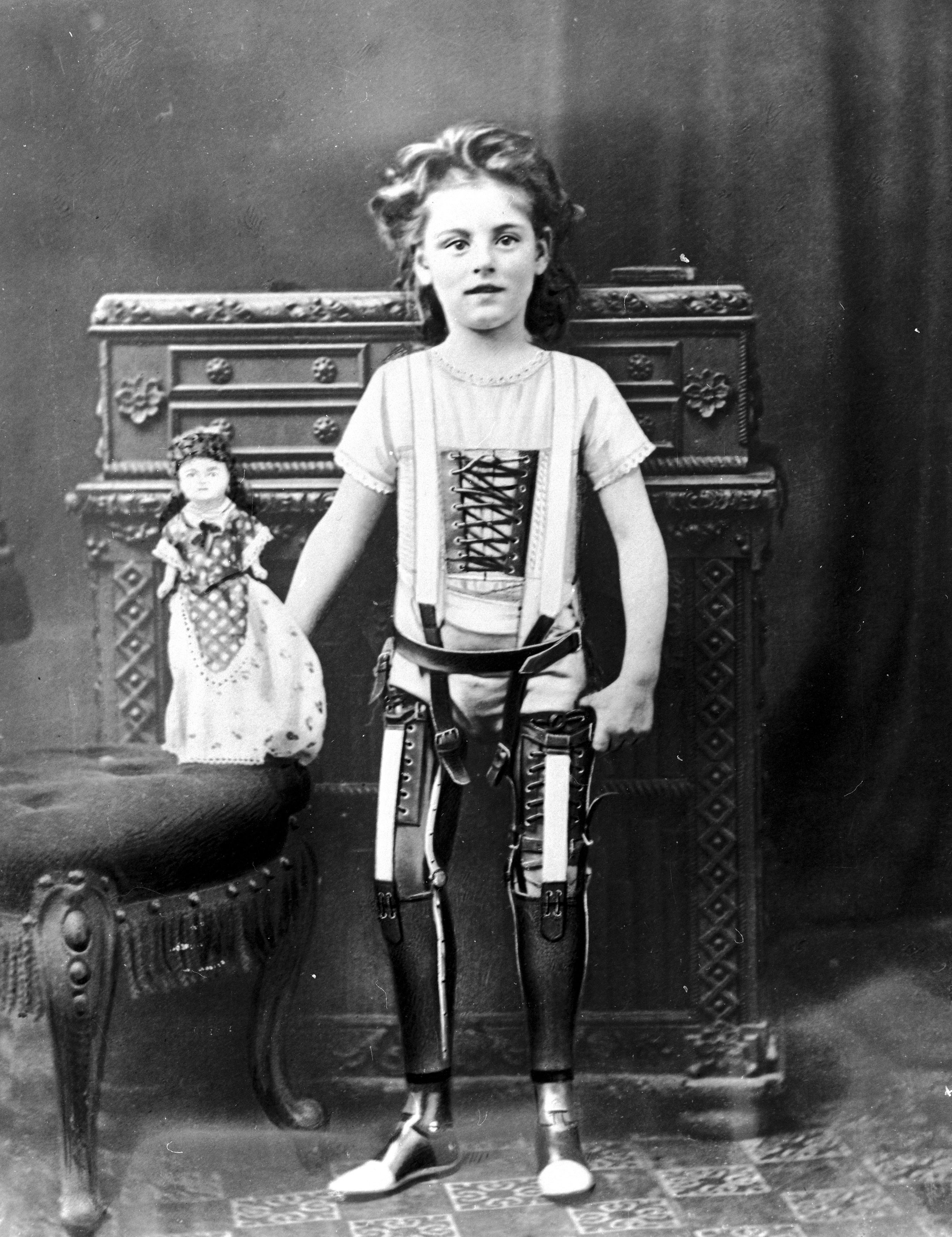 Girl wearing artificial legs made by James Gillingham | Source: Getty Images