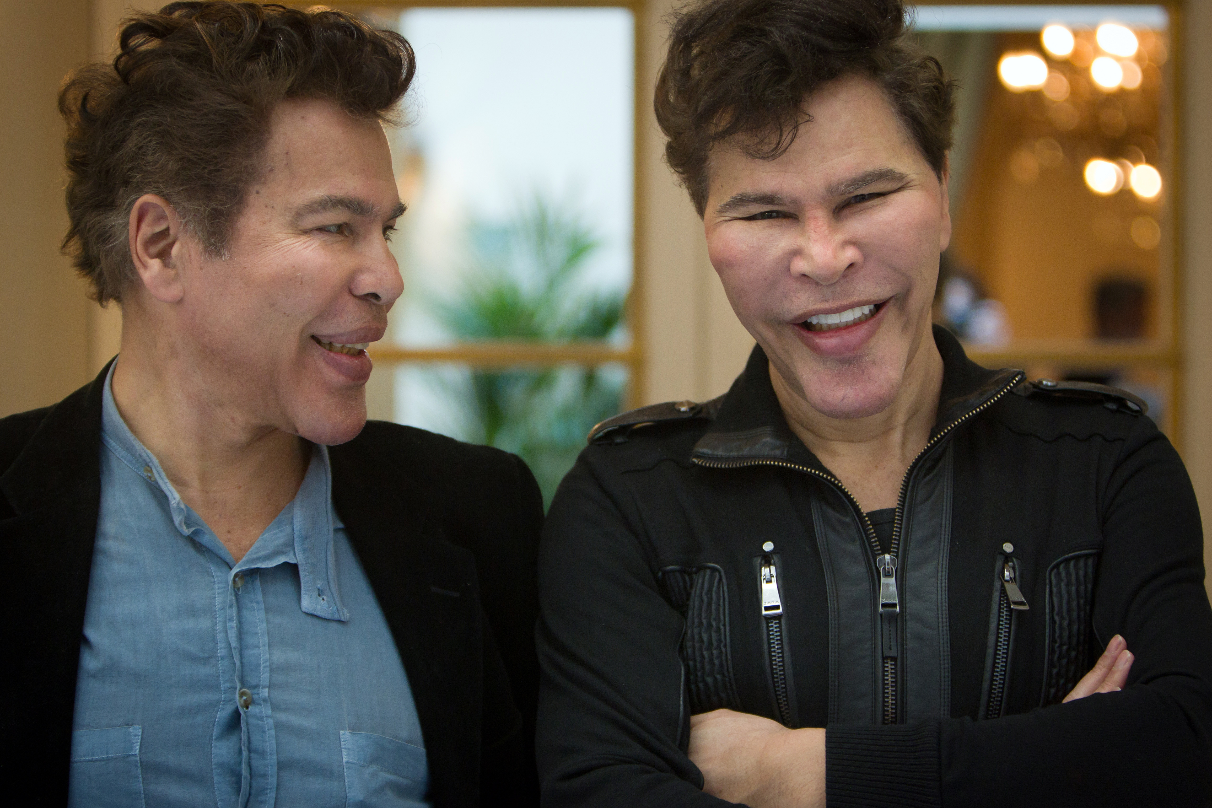 French TV hosts Igor and Grichka Bogdanov pose before attending a lunch gathering of France's most-read writers in 2010 in Paris. As Grichka laughs, his eyes appear to sink into his noticeably tighter, puffier cheeks, while his brother faces him mid-conversation.