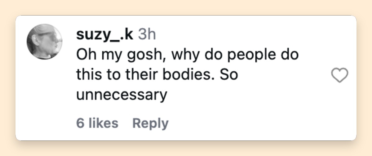 Social media users shared mixed reactions to news of Ripa's surgery. Some questioned the procedure, while others expressed support. | Source: Instagram/people