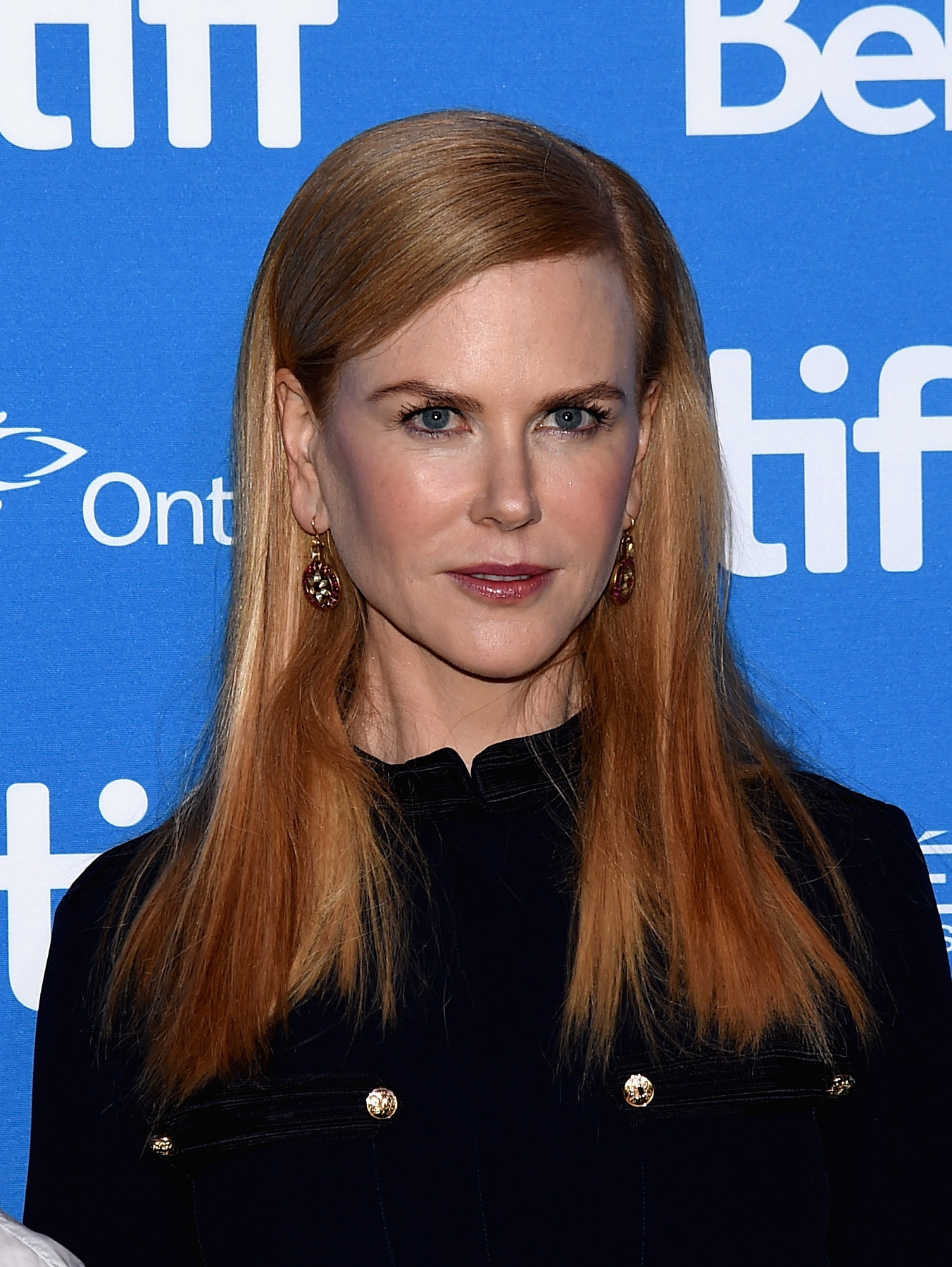 Kidman's appearance at the September 2016 "Lion" press conference showed a return to a noticeably taut, heavily smoothed aesthetic. The line-free brow and distinct fullness in her cheeks made it clear that the public speculation surrounding cosmetic enhancements was far from over. | Source: Getty Images