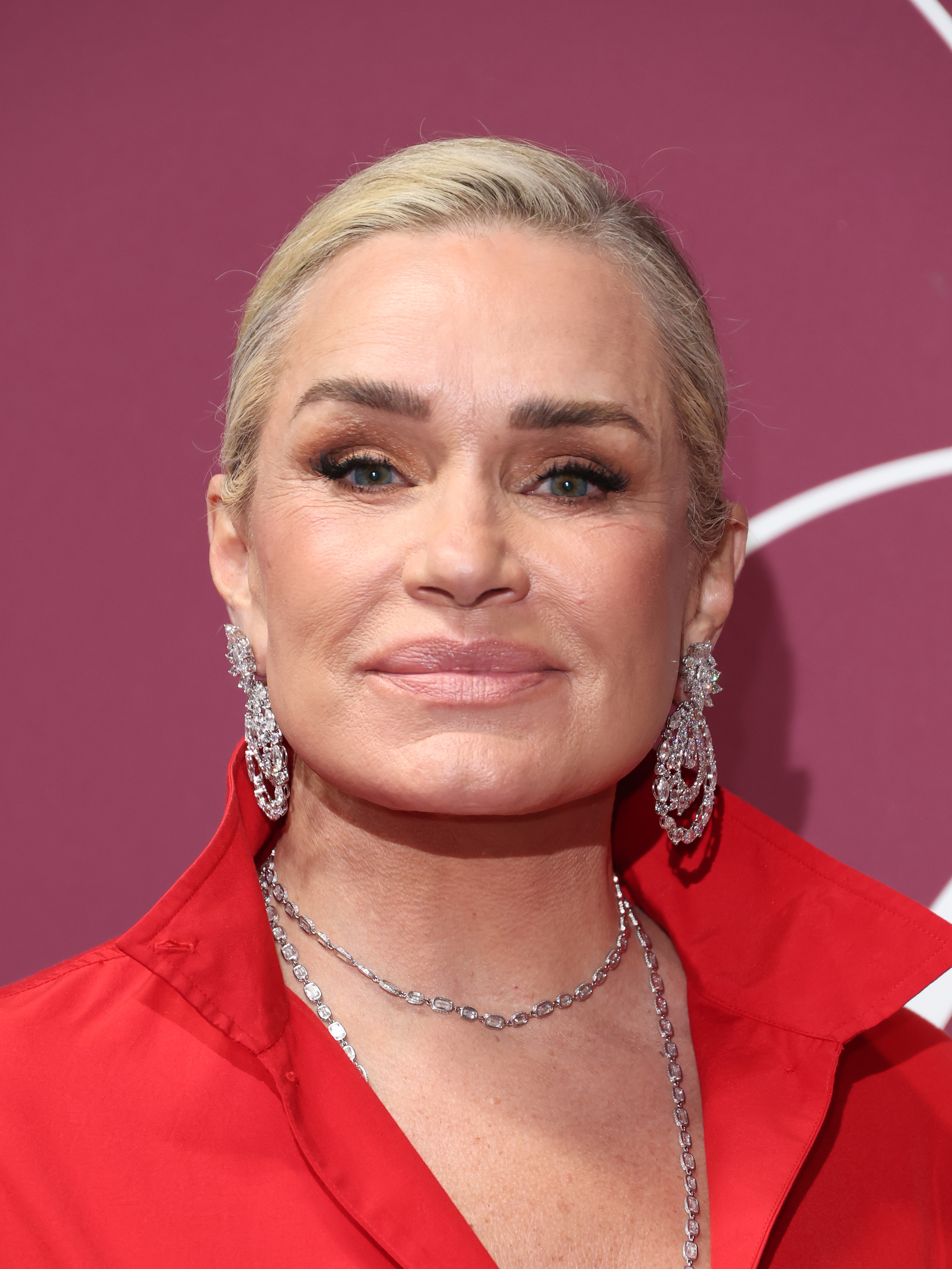 By 2026, Hadid had spent years living without the fillers and Botox she previously discussed. She described those changes as part of a broader shift toward prioritizing her health and defining beauty on her own terms.