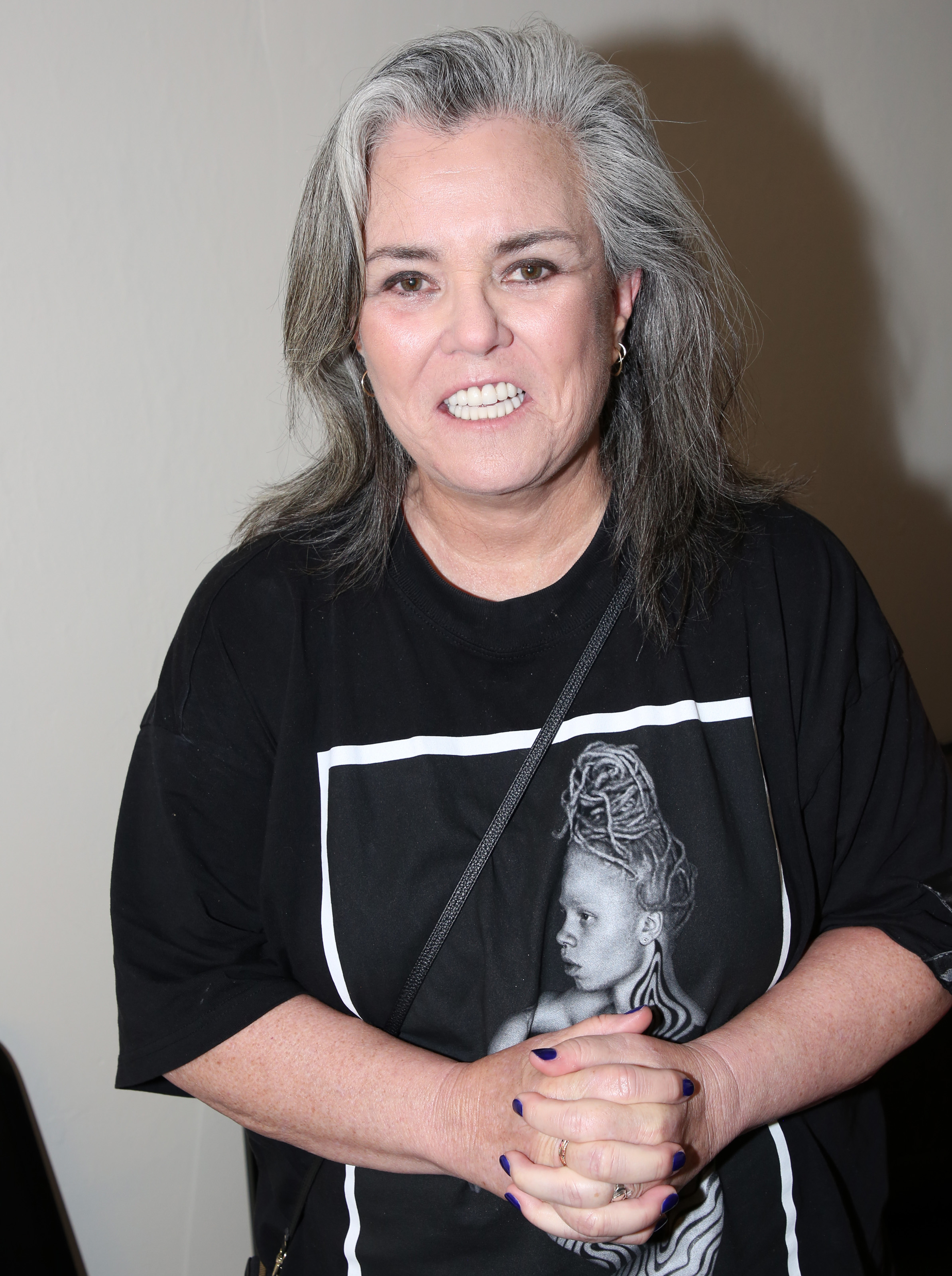 Rosie O'Donnell poses backstage at the opening night of her one-woman show "Common Knowledge" in New York City in 2026. That year, she openly discussed her weight-loss journey and explained that her facelift addressed the marionette lines that became more noticeable after losing weight. | Source: Getty Images