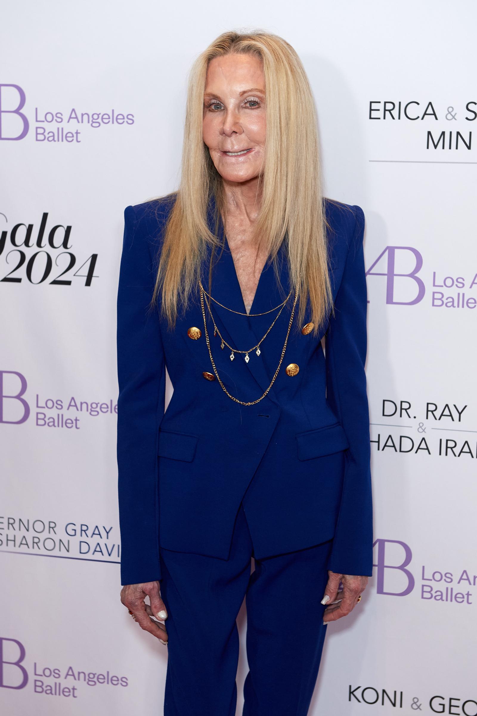 Joan Van Ark posed in a royal blue pantsuit at a Los Angeles Ballet gala, one of several recent appearances that drew mixed reactions online, with some social media viewers speculating about cosmetic surgery. | Source: Getty Images