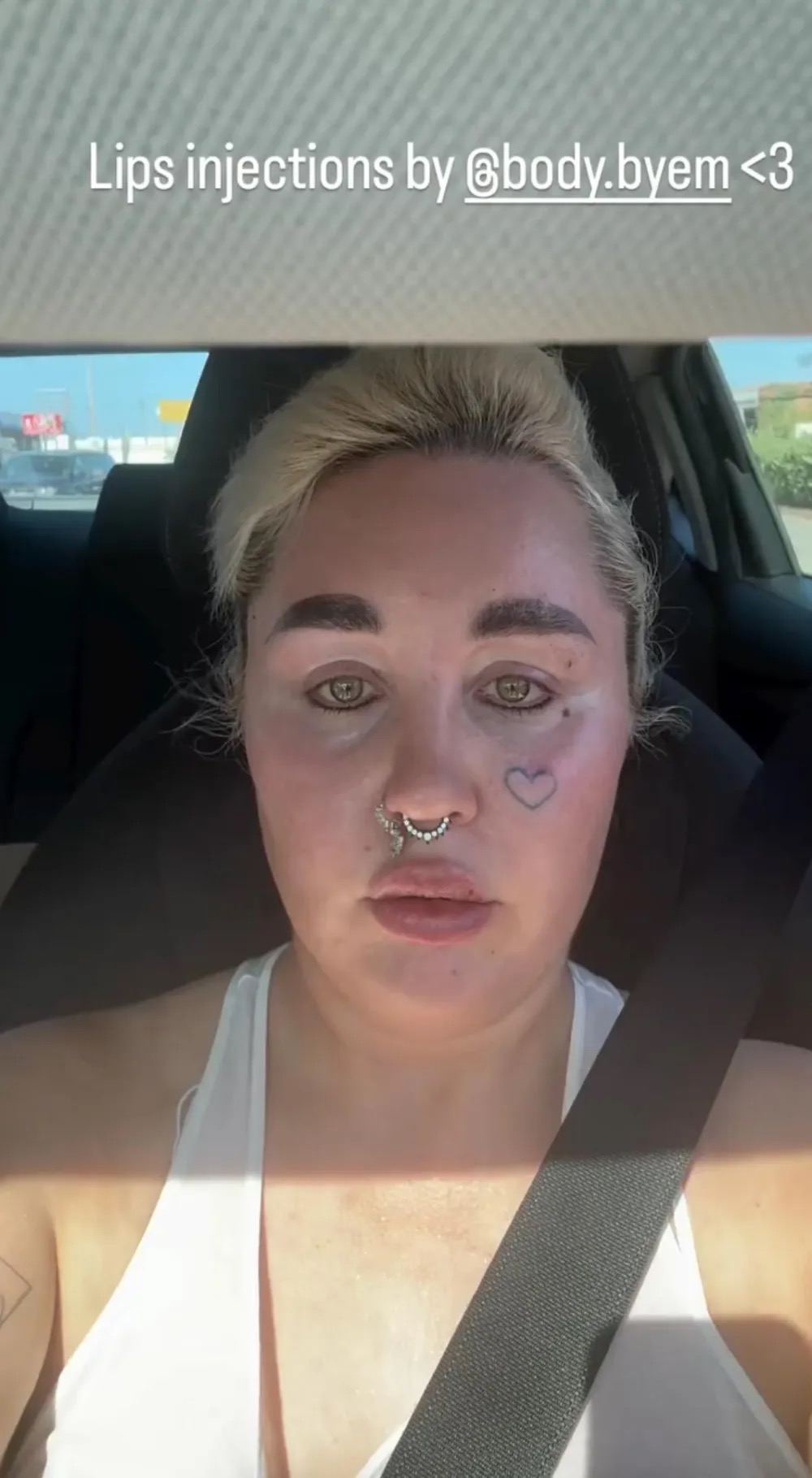 Amanda shared a close-up selfie after receiving lip injections, crediting @body.byem for the procedure. The post offered another glimpse of the cosmetic changes she had been openly documenting. | Source: Instagram @amandapandapandapanda1.