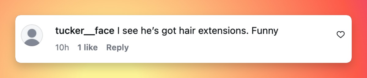 As clear photographs from the evening circulated online, observers shared their thoughts regarding his updated appearance. | Source: Instagram/pagesix