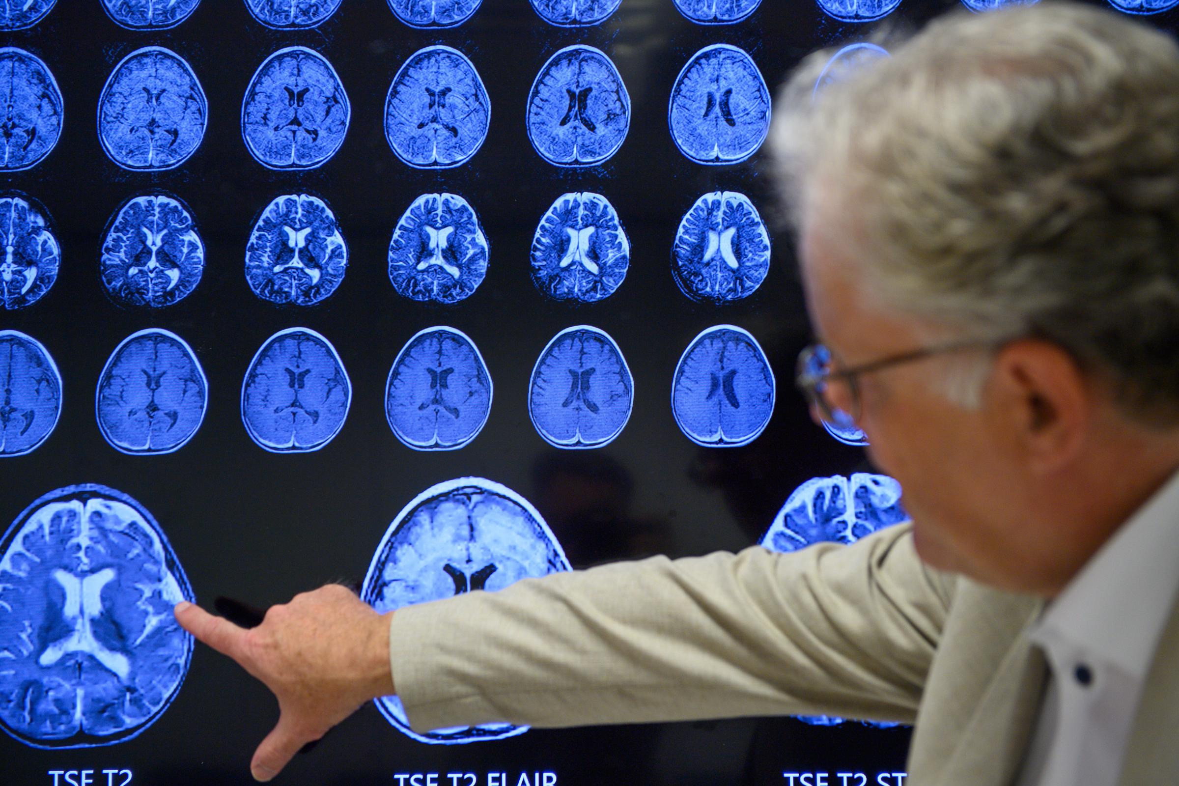 A doctor reviews MRI scans of the brain, illustrating how magnetic resonance imaging allows physicians to examine internal tissues without surgery. | Source: Getty Images.