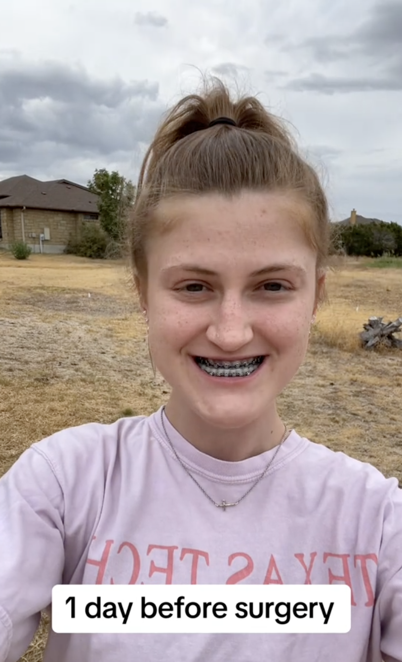 One day before surgery, Virginia Elder documents her final pre-op moment outdoors in a shirt. | Source: TikTok/virginiaeelder