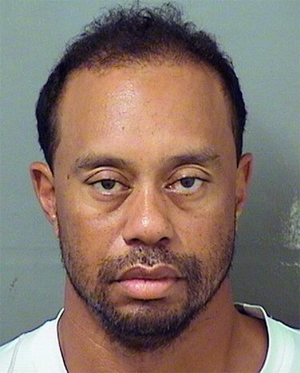 Tiger Woods is seen in a police booking photo after his arrest in Jupiter, Florida on May 29, 2017. | Source: Getty Images