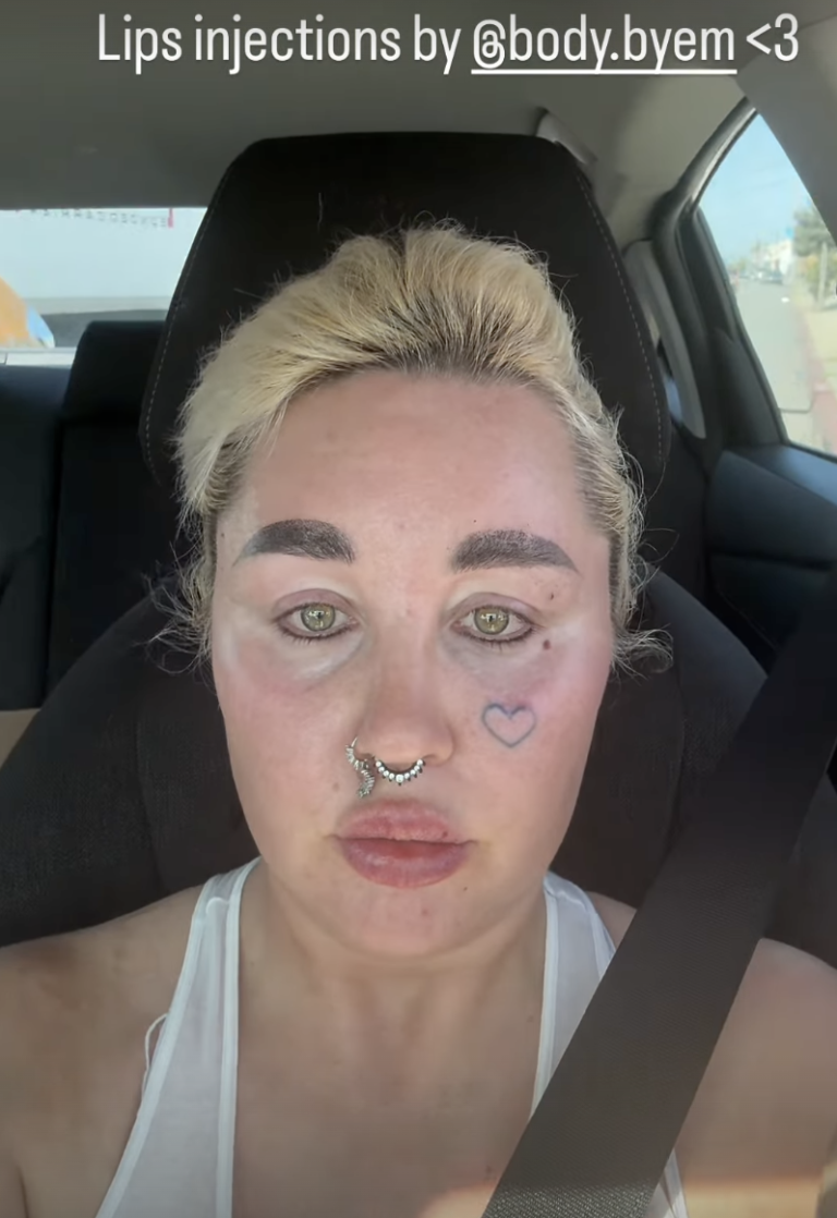 Amanda Bynes showcased her latest cosmetic update in a sunlit selfie taken from her car, drawing attention to her newly plumped lips. | Source: Instagram/amandapandapandapanda1