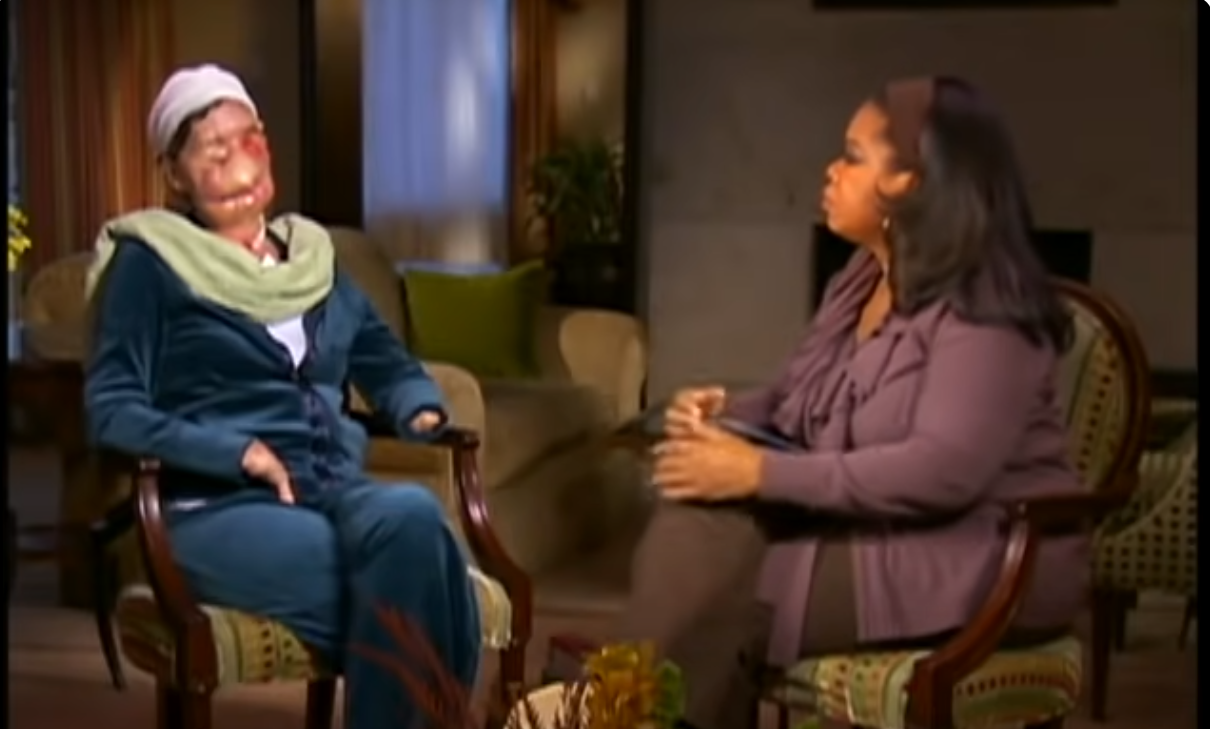 Charla Nash during her interview with Oprah Winfrey as shown on ABC News, dated November 11, 2009 | Source: YoTube/ABCNews