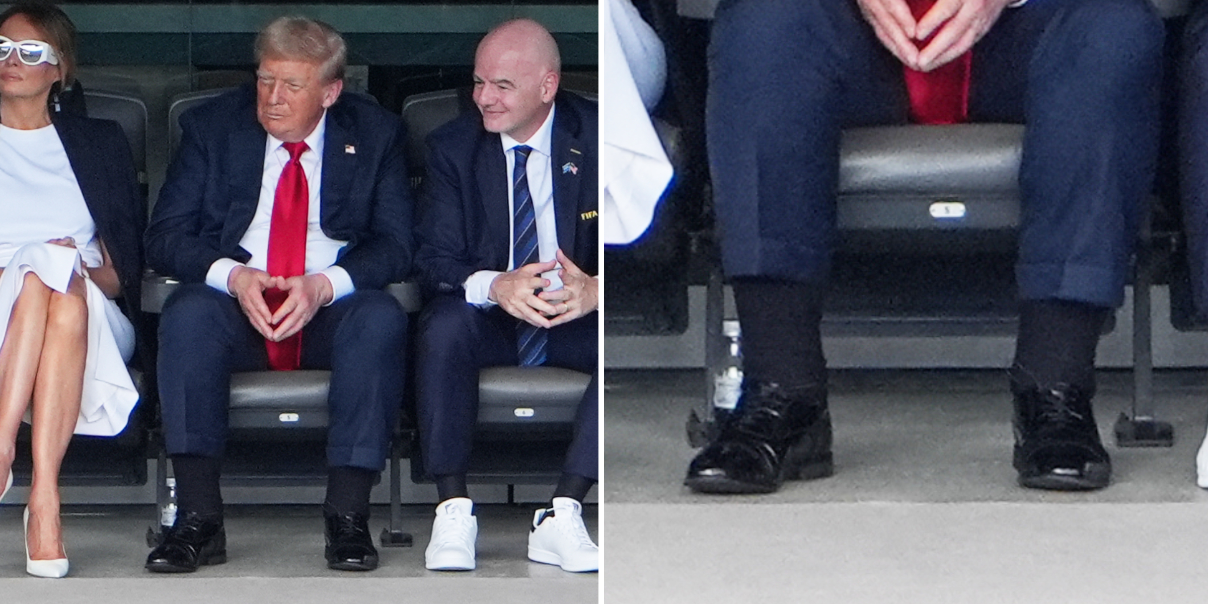 A closeup of President Donald Trump's swollen legs during the FIFA  Club World Cup 2025 Final match between PSG and Chelsea at Met Life Stadium on July 13, 2025 in New Jersey | Source: Getty Images