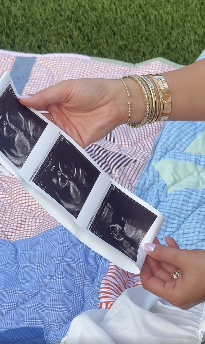 Savannah holds three sonogram images over a colorful patchwork blanket, revealing a glimpse of her unborn baby. She later shared another ultrasound image on Instagram Stories, expressing her excitement about becoming a mother. | Source: Instagram/savannahchrisley