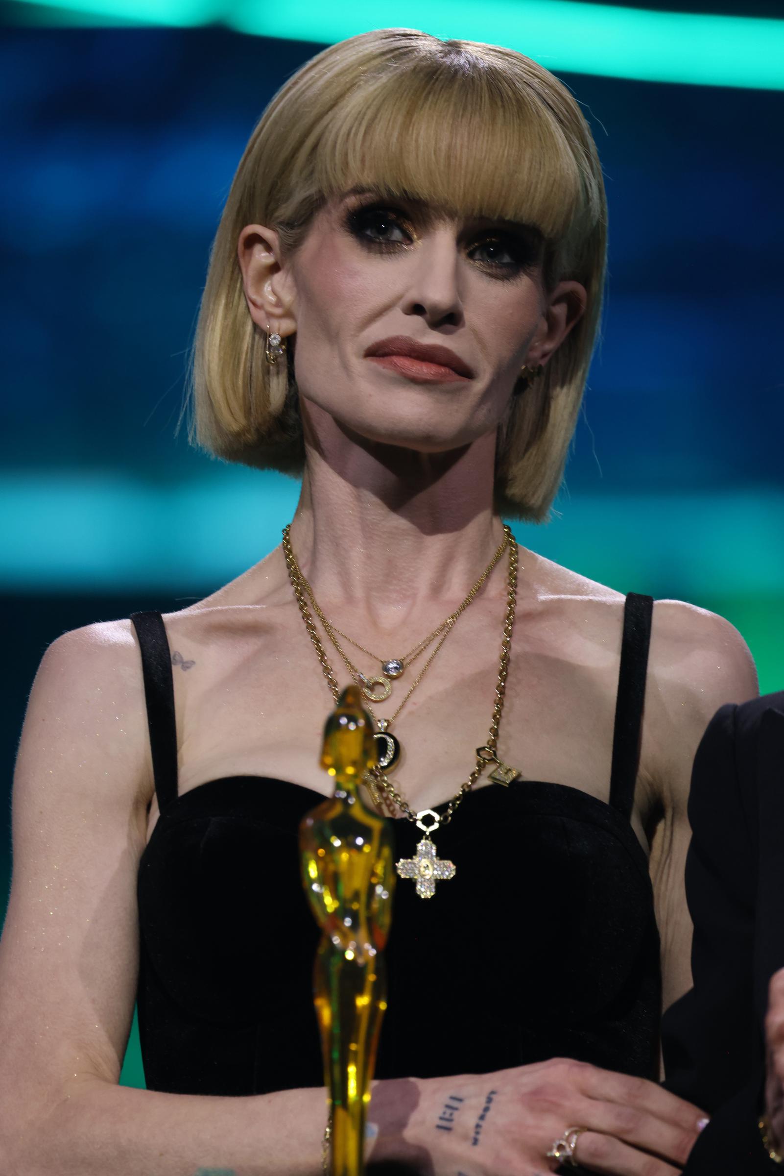 As seen in this photo and the one above, Kelly attended The BRIT Awards at Co-op Live on February 28, 2026, in Manchester, England, where she accepted the "Lifetime Achievement" award on behalf of her late father. Fortunately, her latest appearance suggests her physical well-being is moving back in a healthier, more vibrant direction. Keep scrolling to see it!