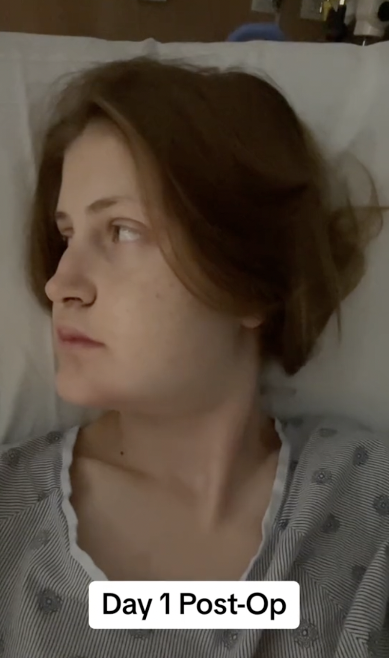A side glance on Day 1 post-op reveals the extent of swelling and fatigue in Virginia Elder's recovery. | Source: TikTok/virginiaeelder