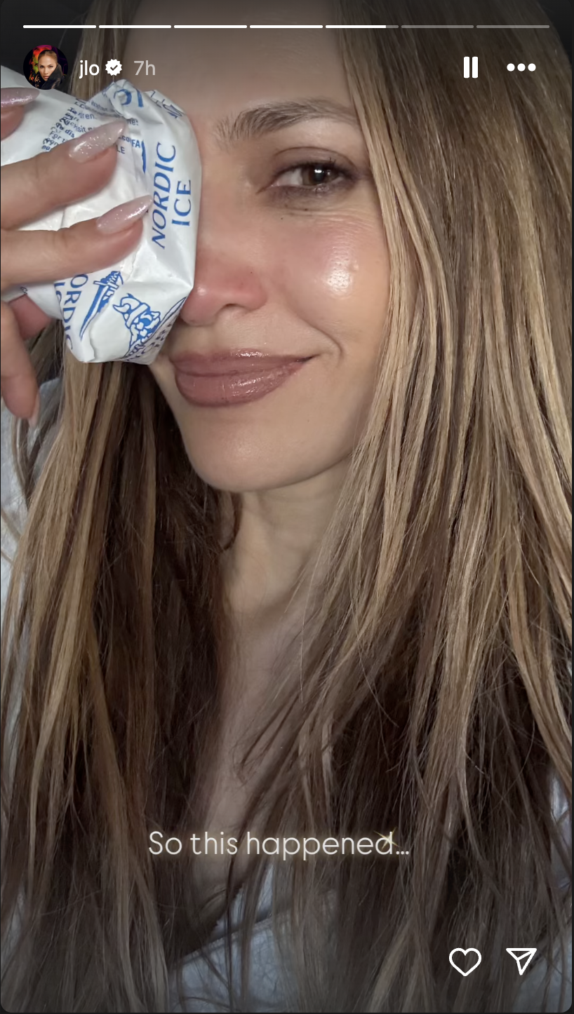 Jennifer Lopez icing her nose, posted on her Instagram stories on May 13, 2025 | Source: Instagram/jlo
