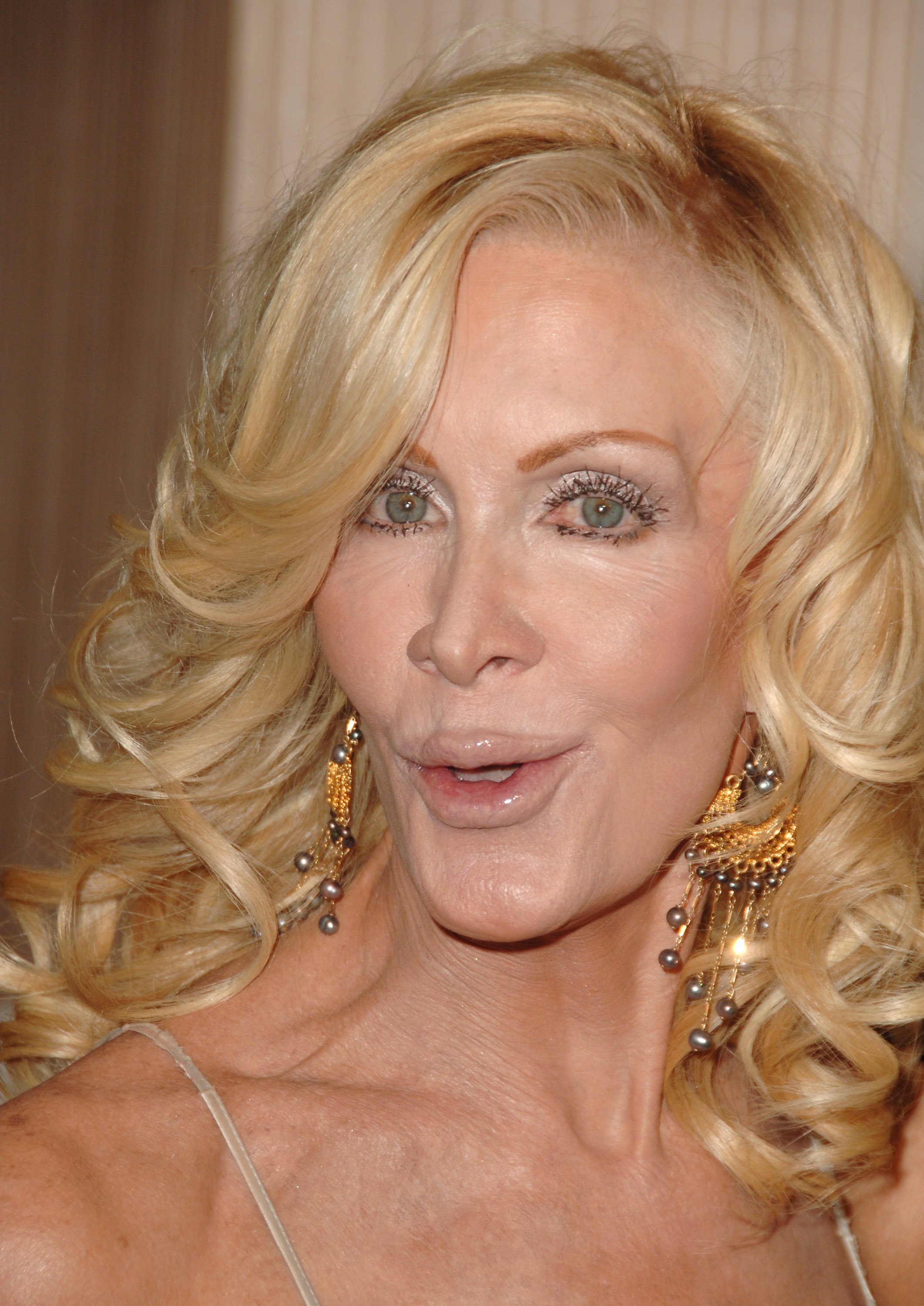 As Joan Van Ark continued making public appearances, attention increasingly shifted from her celebrated career to widespread discussion about her changing appearance, sparking years of public speculation. | Source: Getty Images